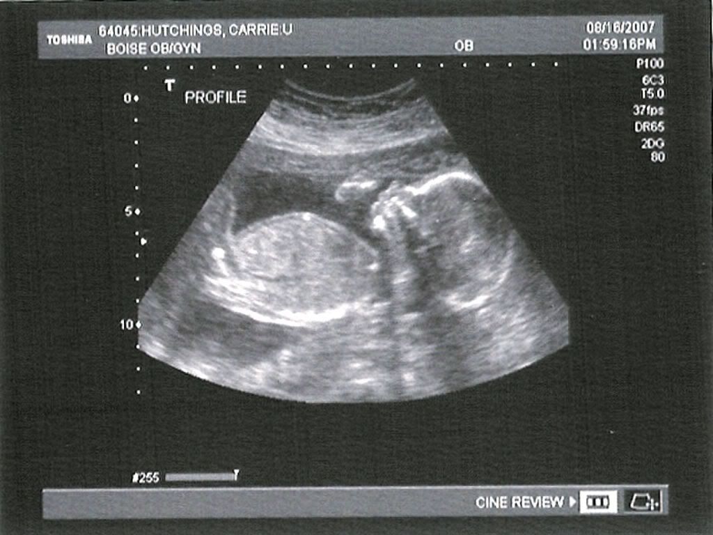 boy on ultrasound