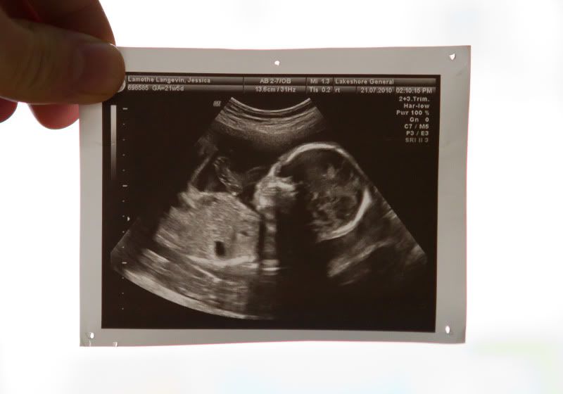 IMAGE: http://i224.photobucket.com/albums/dd109/keny_paintball/IMG_1176.jpg