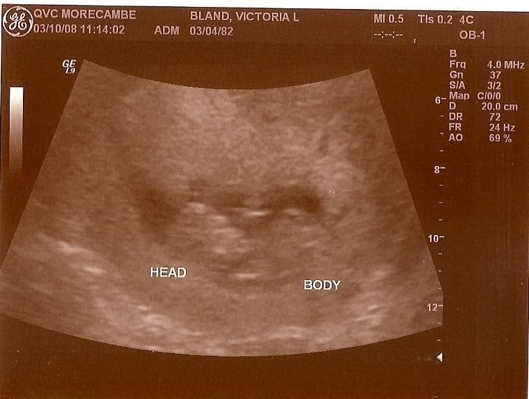 scan is done dating How a scan is done dating How a