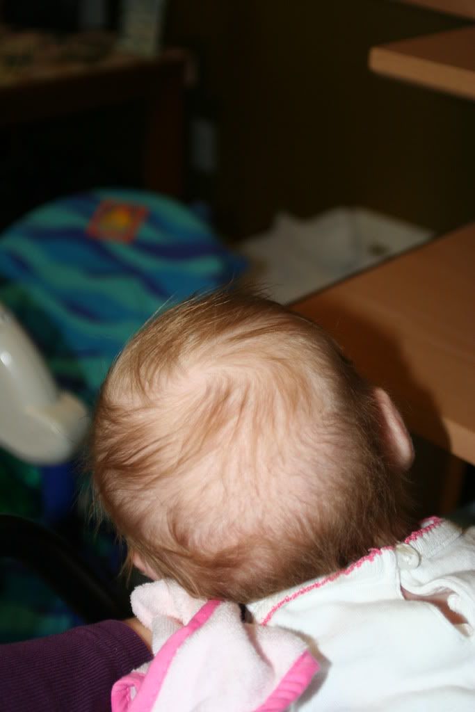 baby bald spots JustMommies Message Boards